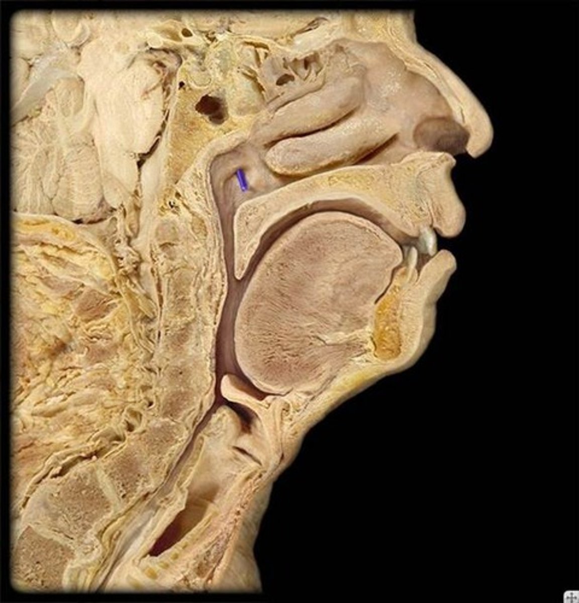 <p>Identify this passageway. This passageway is also known as the eustachian tube.</p>