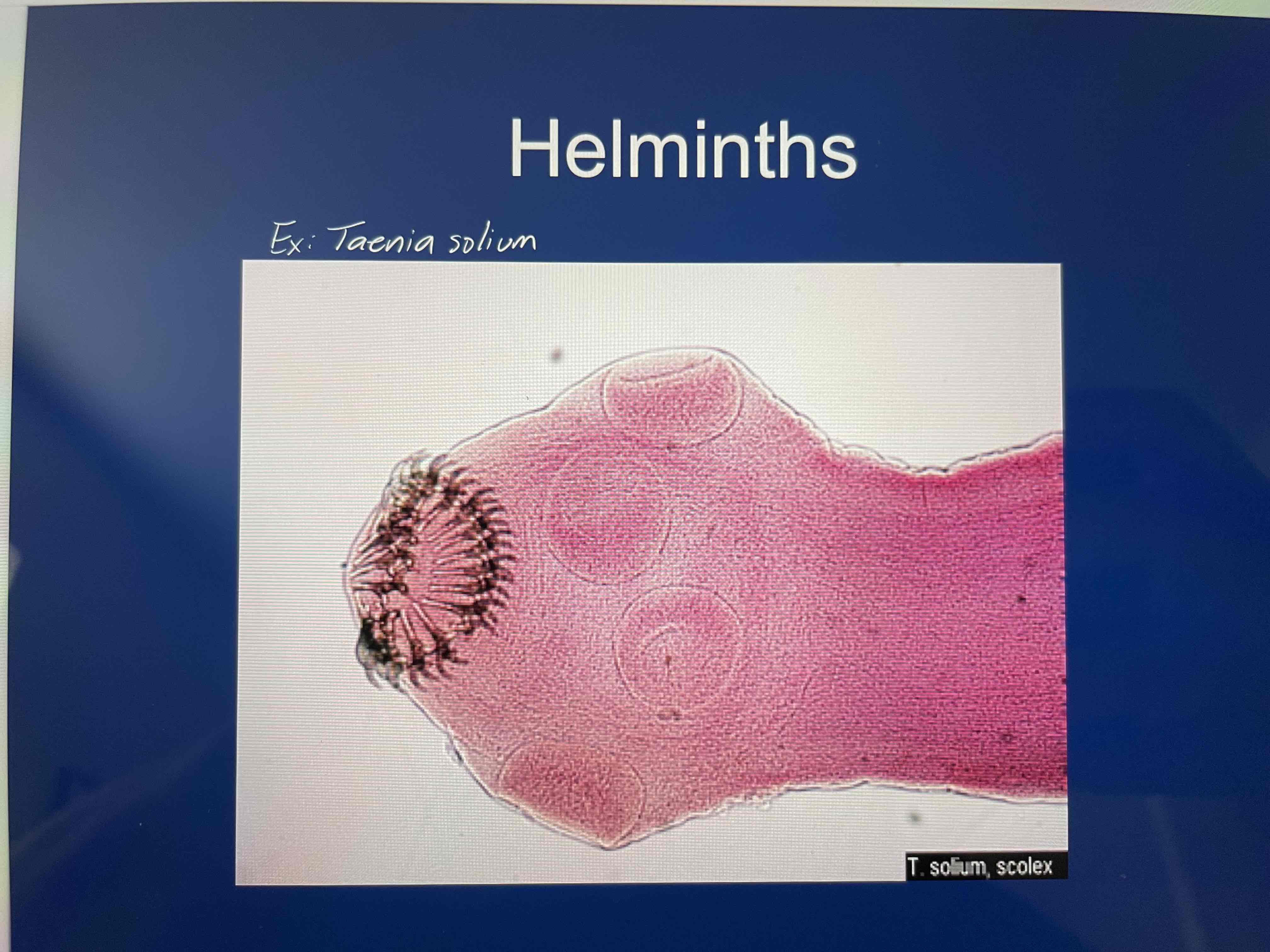 <ul><li><p><em>Taenia solium</em></p><ul><li><p>“pork tape worm”</p></li></ul></li><li><p><em>Enterobius vermicularis</em></p><ul><li><p>“pinworm”</p></li></ul></li></ul><p></p>