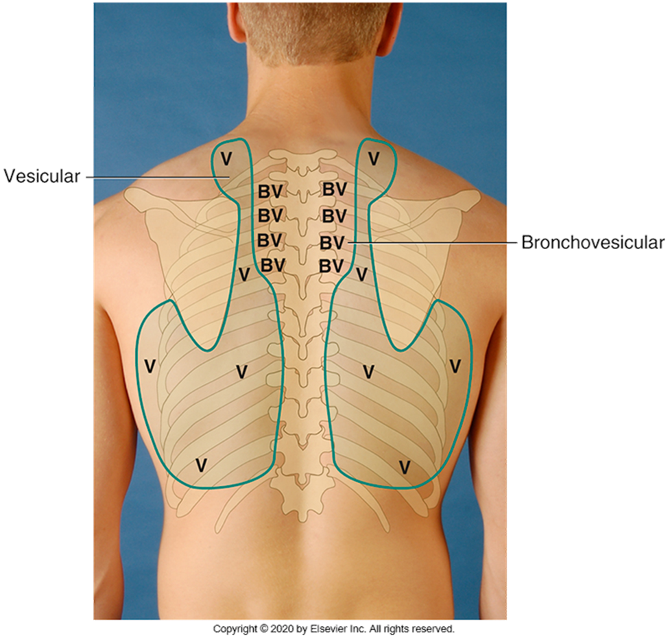 <p><strong><span style="font-family: Arial">INSPECTION: THORACIC CAGE</span></strong></p><p><span style="font-family: Arial">•Shape and configuration of chest wall.</span></p><p><span style="font-family: Arial">•Anteroposterior Diameter = Ratio 1:2</span></p><p><span style="font-family: Arial">•Position of person to breath.</span></p><p><span style="font-family: Arial">•Assess skin color and condition.</span></p><p><span style="font-family: Arial">•Note any lesions; inquire about changes.</span></p>