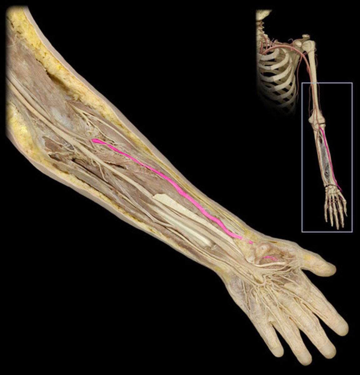<p>The major artery in the forearm; it is palpable at the wrist on the thumb side.</p>