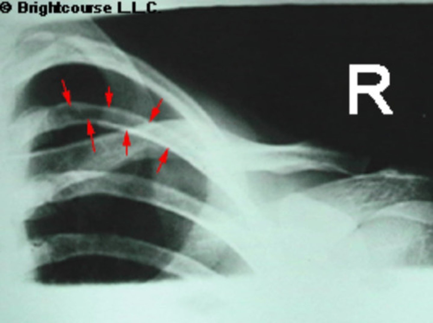 <p>What is being pointed out by the arrows in the image?</p>