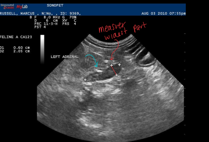 <p>Adrenal Glands and Lymph Nodes on Ultrasound</p>