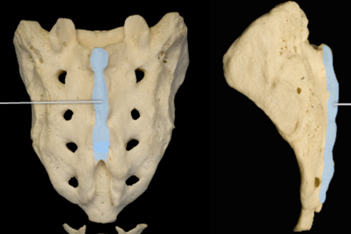 <p>name the ridge formed by the fused spinous processes of the sacral vertebrae.</p>
