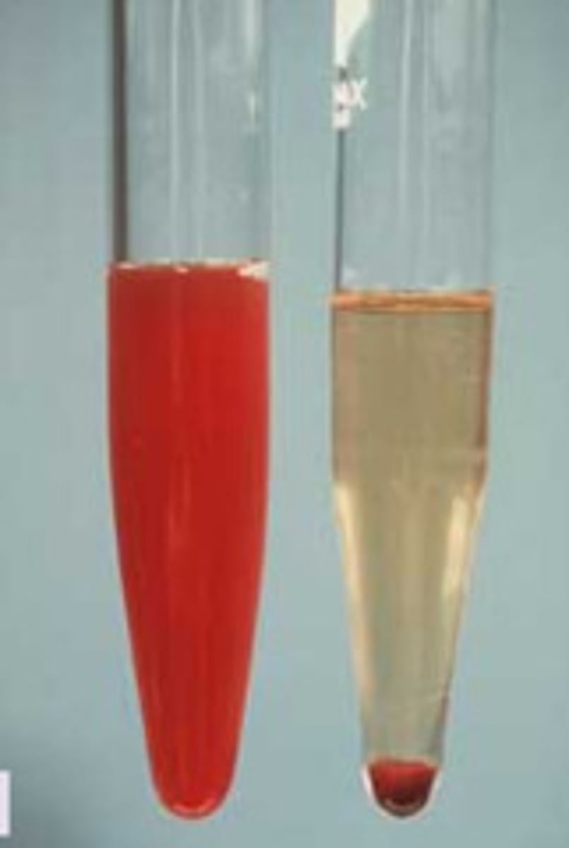 <p>The liquid on top of material deposited by settling or centrifugation.</p>