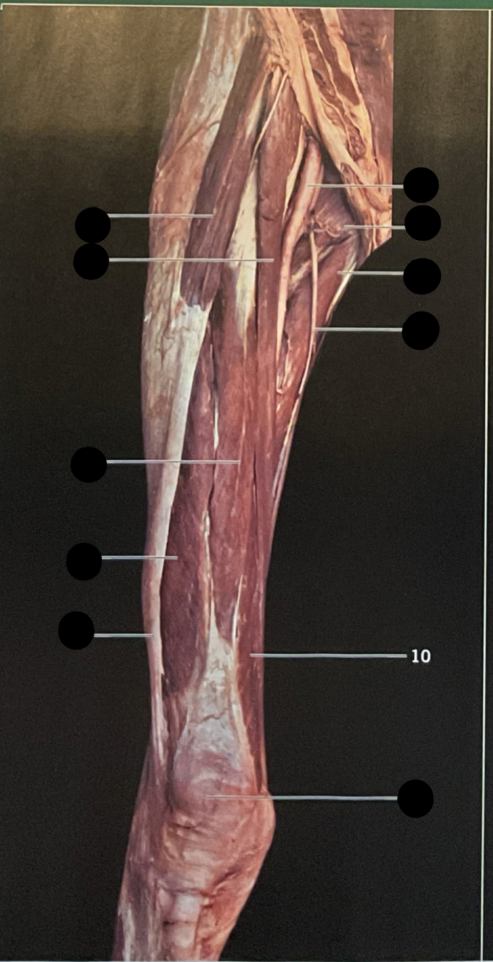 knowt flashcard image