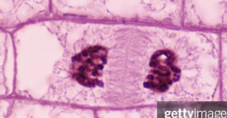 <p>Which phase of mitosis is this? Why is it important? </p>