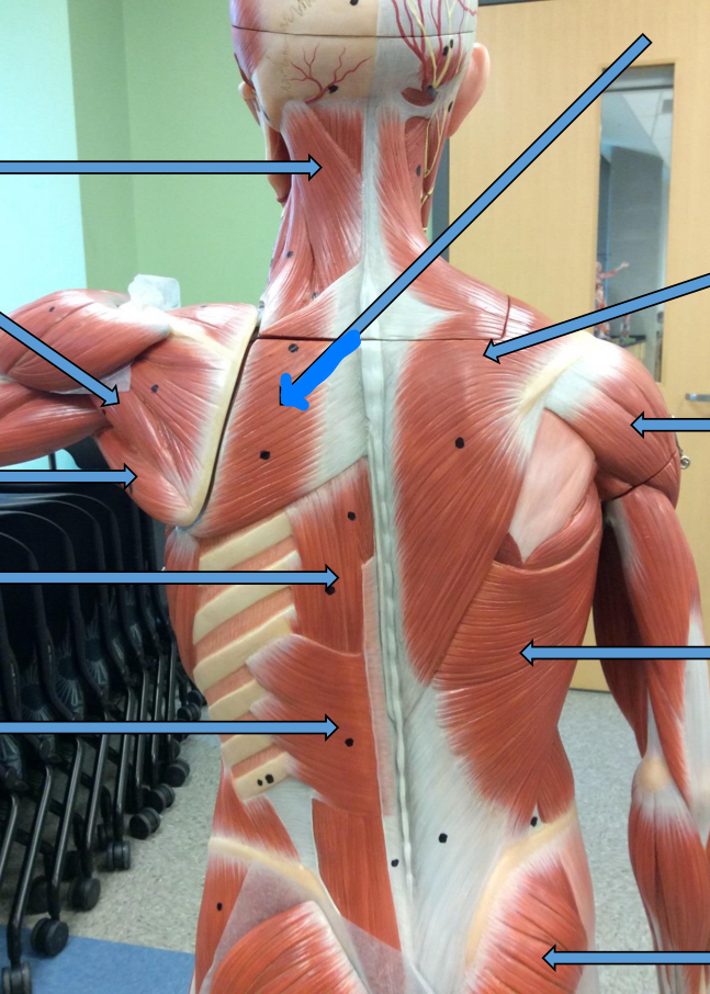 <p>Identify this muscle?</p>