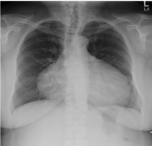 <p>What is this patient presenting with?</p>