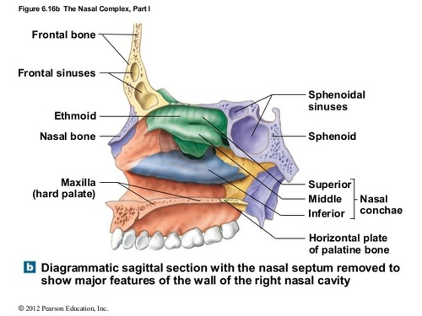 <p>frontal, sphenoid, and ethmoid (superior walls)</p><p>maxilla, lacrimal, ethmoid, inferior nasal conchae (lateral walls)</p><p>maxilla and nasal bones (bridge of nose)</p>