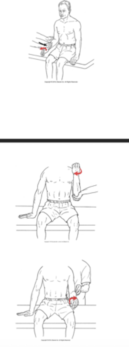 <p>What test is being performed in the image?</p>