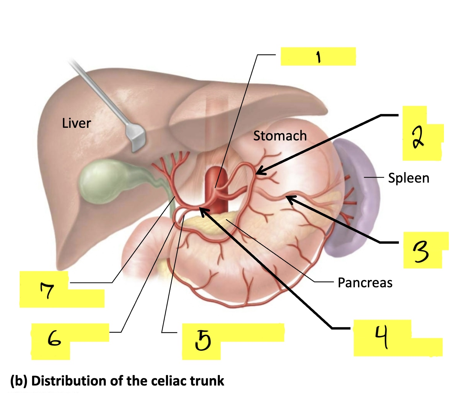 <p>what is #2 in this image?</p>