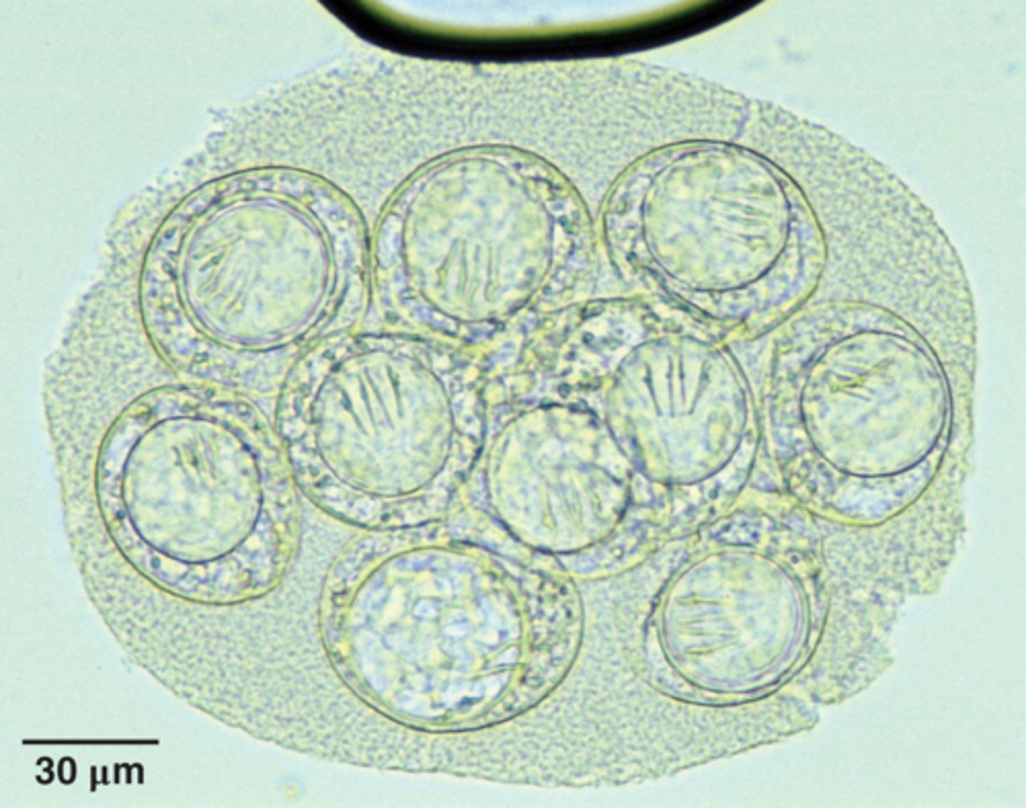 <p>What parasite is this if it is from a dog</p>