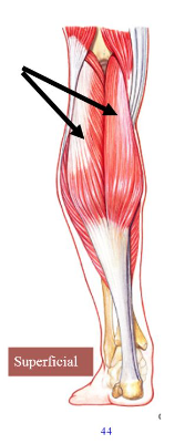 <p>Origin: Medial and lateral condyles of femur</p><p>Insertion: With soleus into calcaneus via calcaneal tendon</p><p>Action: Flexes tibia and plantar; flexes foot</p>