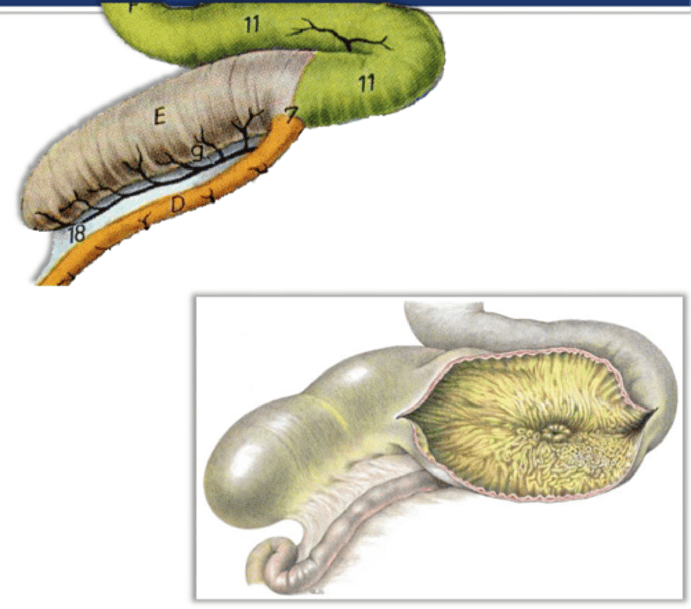 <p>though ruminants possess the ileocecal fold, ileal orifice, and ileal papilla...they do not possess a ____ _____ ____ and the cecum and ascending colon communicate freely</p>