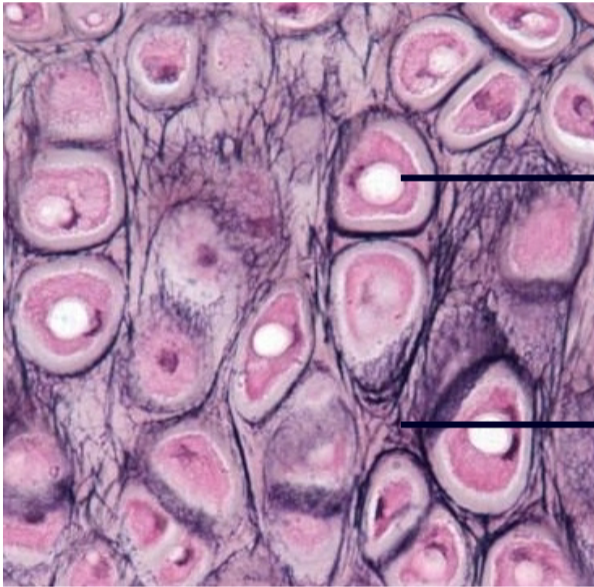 1. Similar to hyaline cartilage
2. Contains lots of elastic fibers
3. VERY resilient and flexible
4. Tolerates repeated bending
5. Found in
- Pinna (outer ear)
- Epiglottis