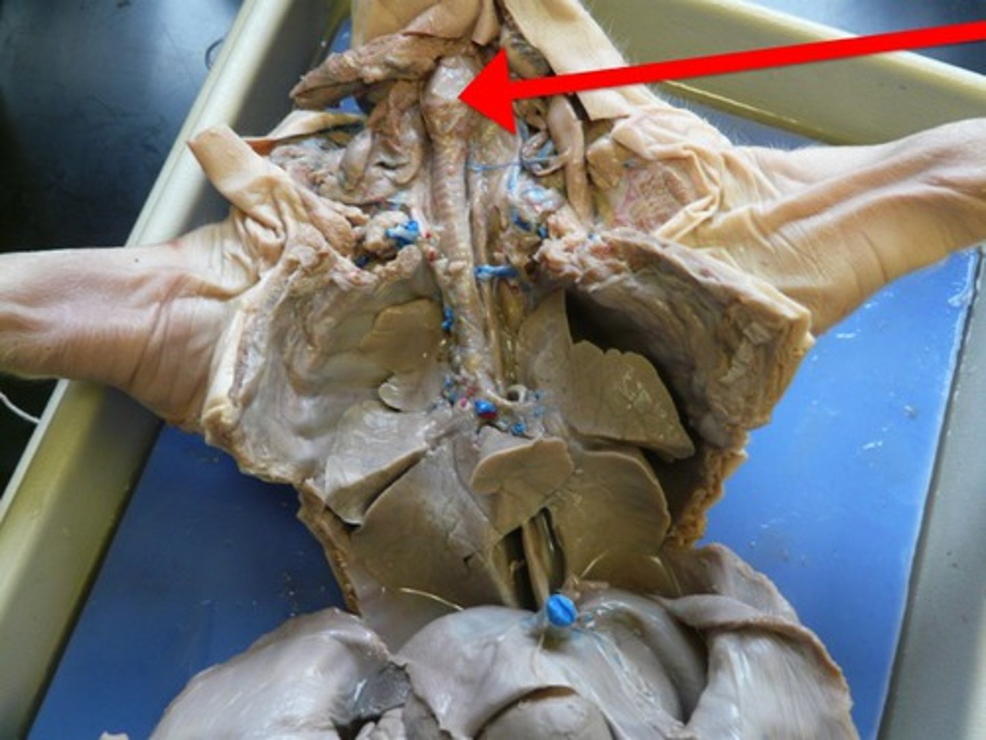 <p>Contains the vocal cords-voice box.</p>