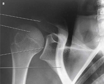 <p>What type of projection, position and anatomy is this?</p>