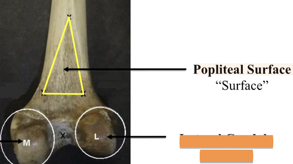 <p>Popliteal surface </p>