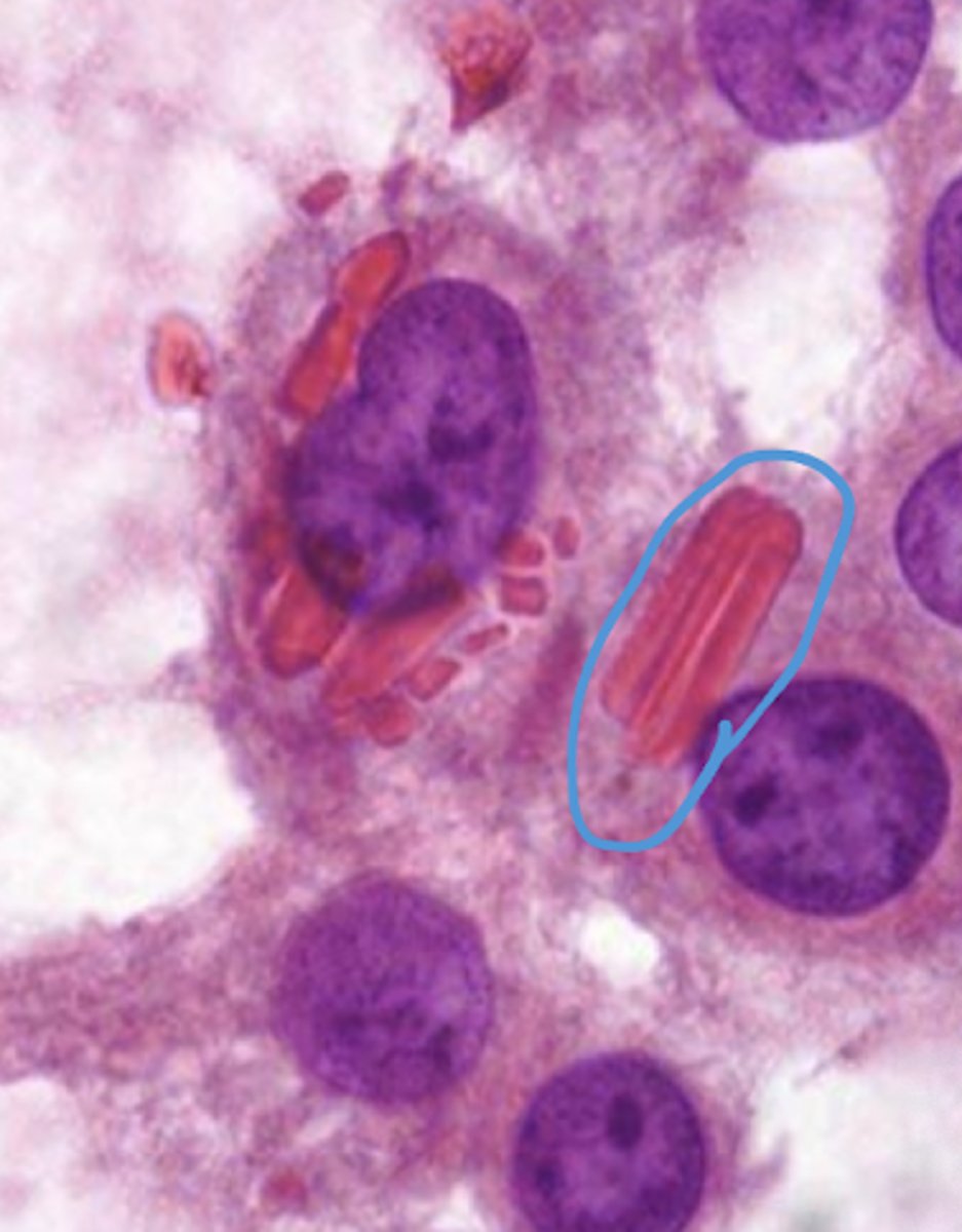 <p>what is the structure shown</p>