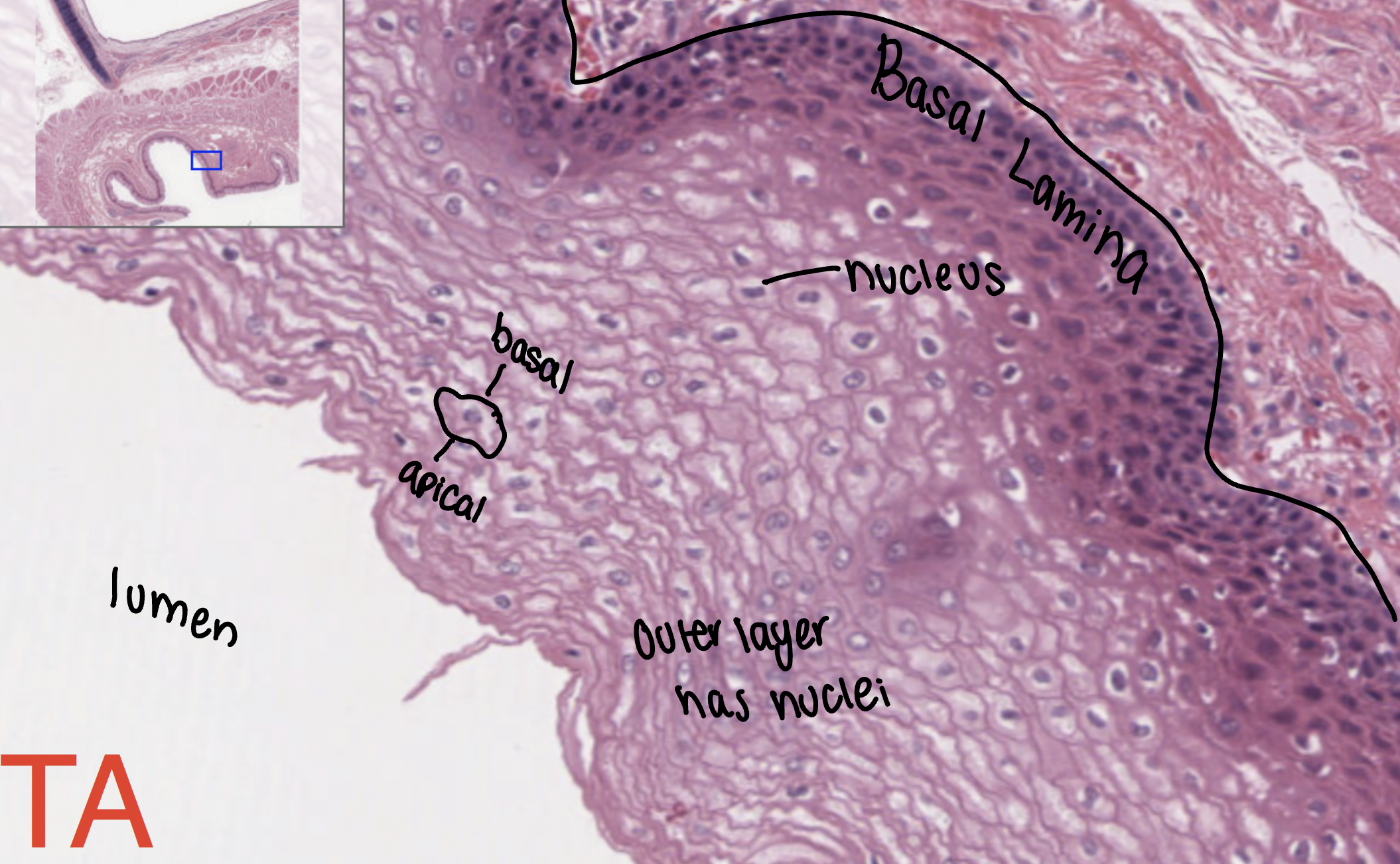 <p>lines the esophagus, mouth, and vagina</p>
