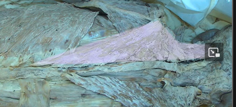 <p>A muscle that originates on the occipital bone and thoracic vertebrae, inserts on the scapula, and functions to fix, rotate, and elevate the scapula.</p>