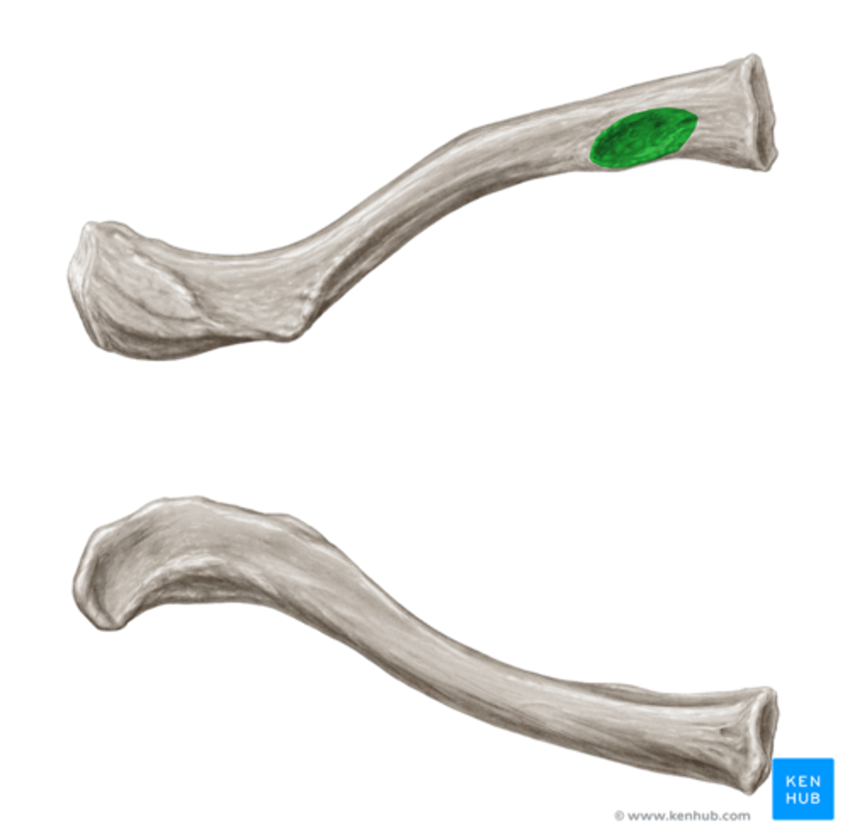 <p>lies on medial end (sternal extremity) of the inferior surface of the CLAVICLE, anchors costoclavicular ligament</p>