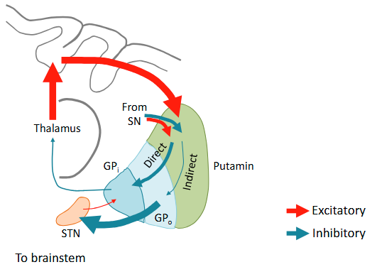 <p>reduced activity in the indirect pathway reduces the normal inhibition on the thalamus and brainstem, resulting in excessive, unwanted movements</p>