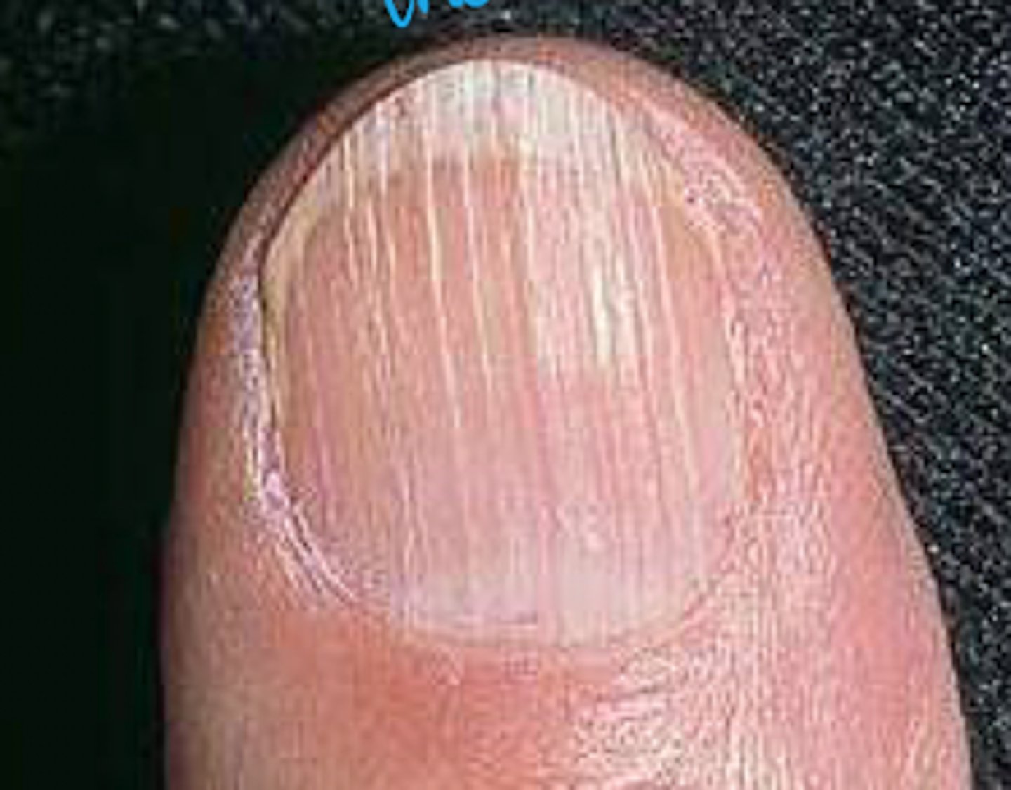 <p>What is the diagnosis?</p>