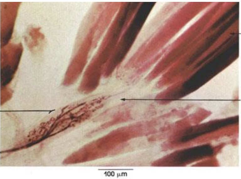 <p>identify this. It is used for Musculoskeletal positioning.</p>