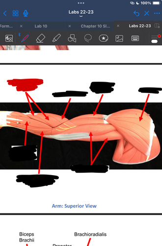 <p>What muscle is this?</p>