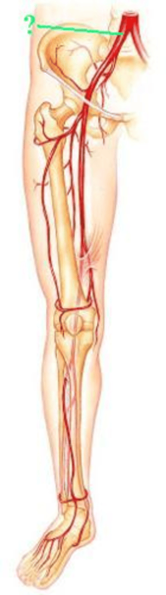 <p>Identify the indicated blood vessel.</p>