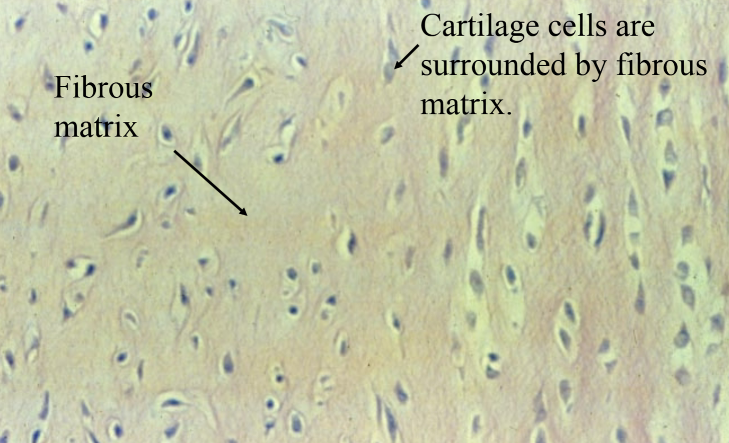 <p>Where is fibrocartilage found? (connective tissue)</p>