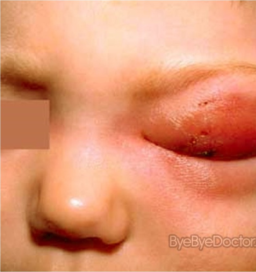<p>What condition is this and how dangerous can it be?</p>