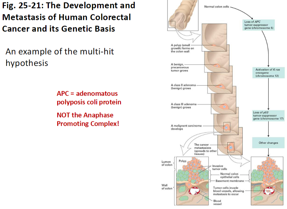 <p><strong>Concept</strong><br> Example of the <strong>Multi-Hit Hypothesis</strong> explaining tumor development and progression</p><p><strong>Genetic Basis</strong><br> <strong>APC</strong> = <strong>adenomatous polyposis coli protein</strong><br>  (Not to be confused with <strong>Anaphase Promoting Complex</strong>)</p><p><strong>Key Idea</strong><br> Mutations accumulate in <strong>specific genes</strong> like APC, driving the formation of <strong>colorectal tumors</strong> and potentially <strong>metastasis</strong></p>