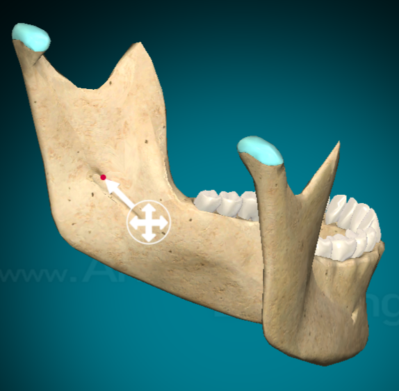 <p>Mandibular foramen</p>