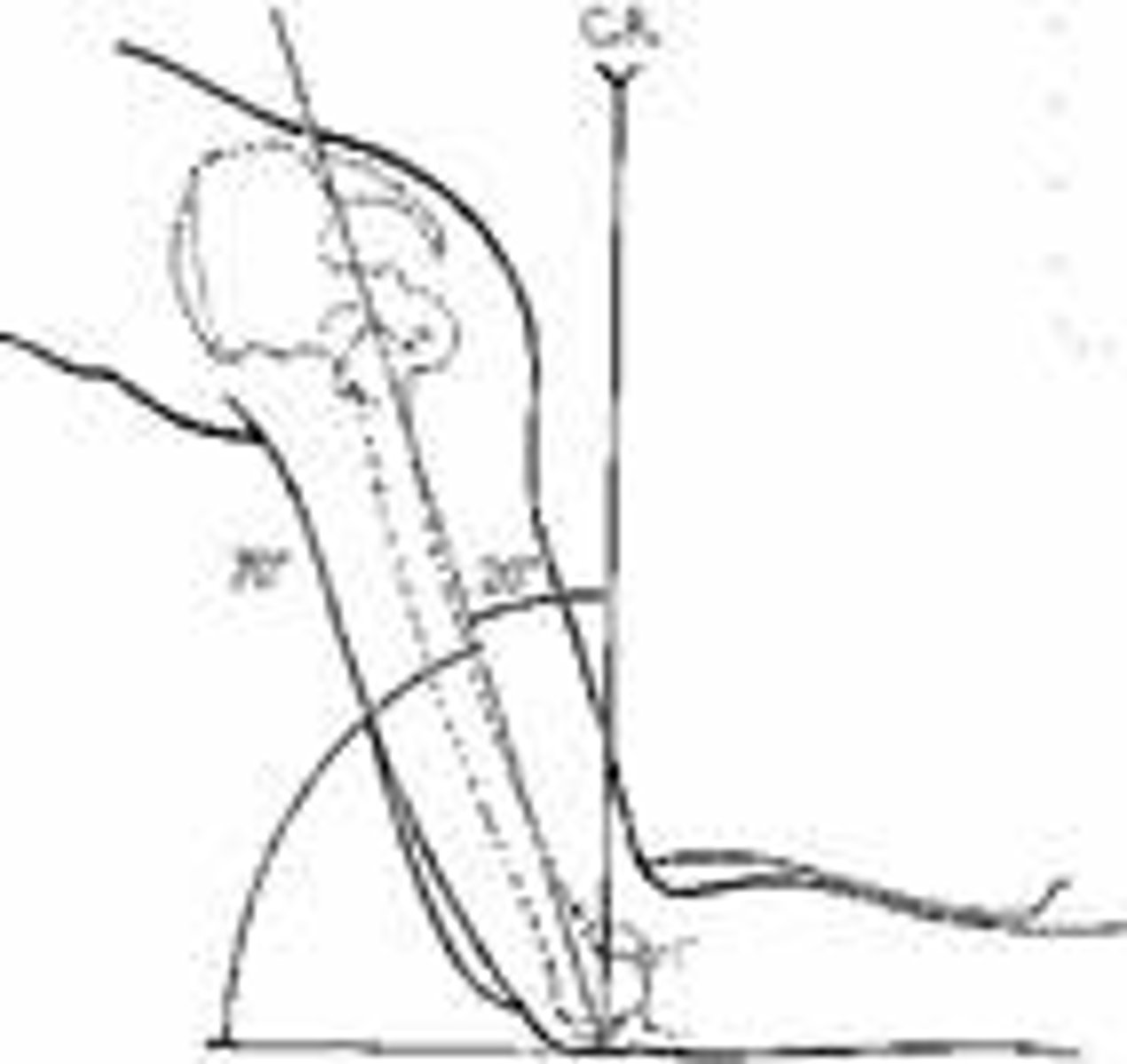 <p>intercondylar fossa</p>