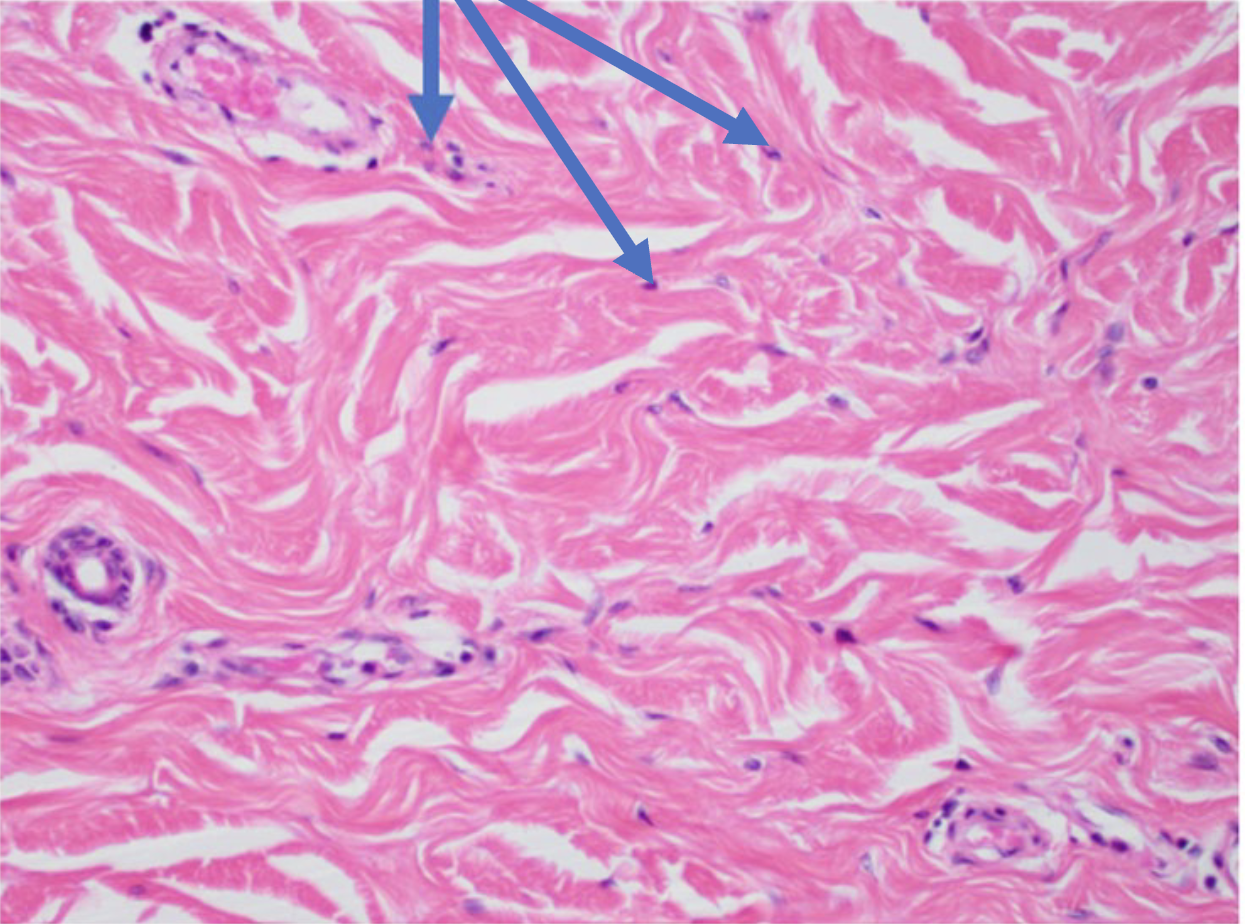 <p>What is the arrow point at?</p>