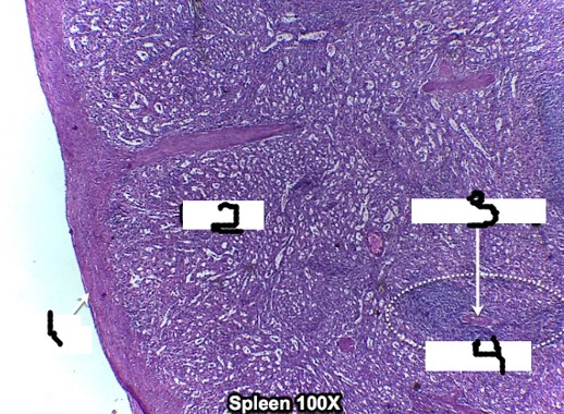 <p>1 (spleen)</p>