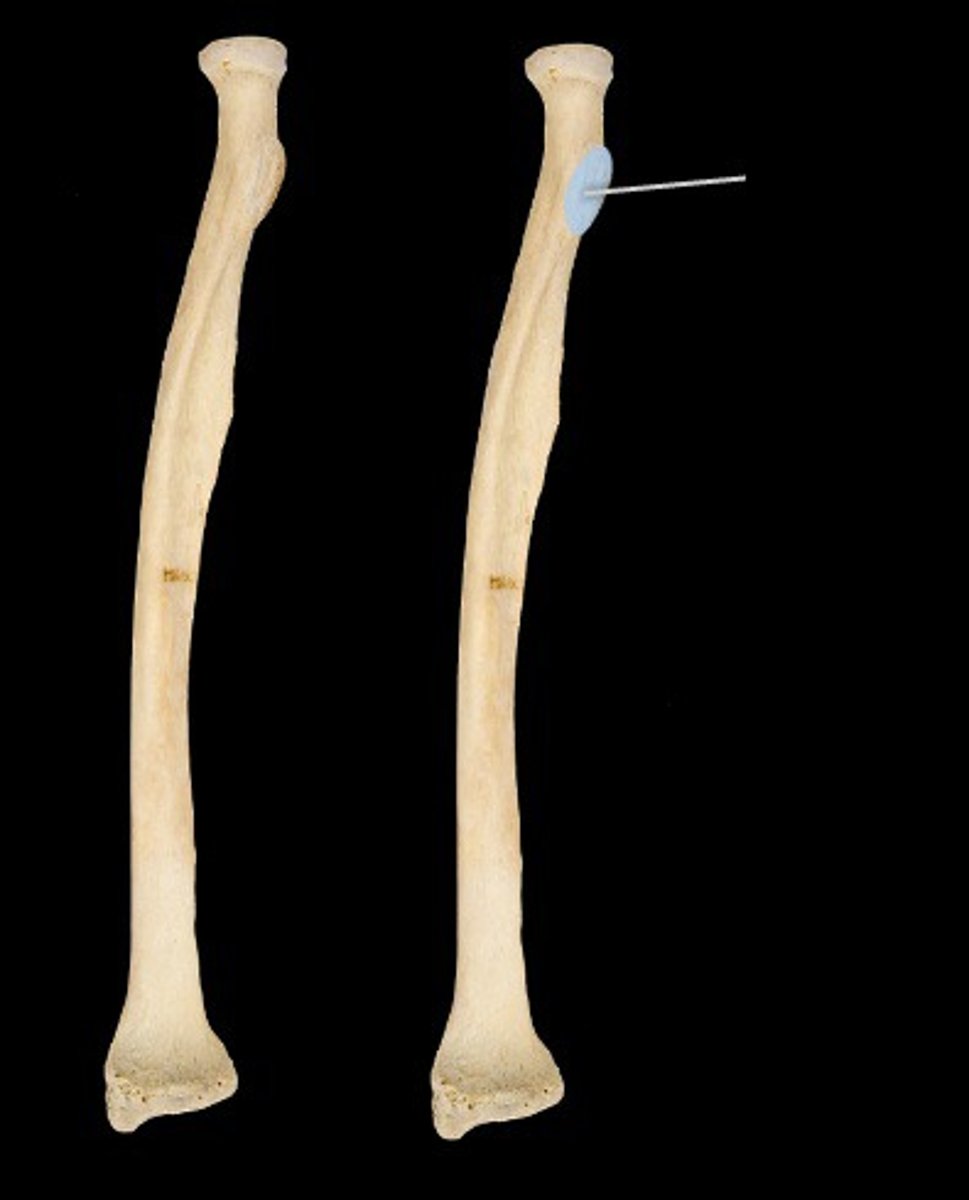 <p>feature</p><p>groove under the neck of radius</p>