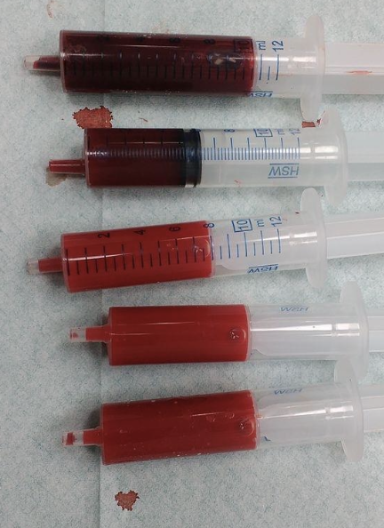 <p>arterial blood</p>