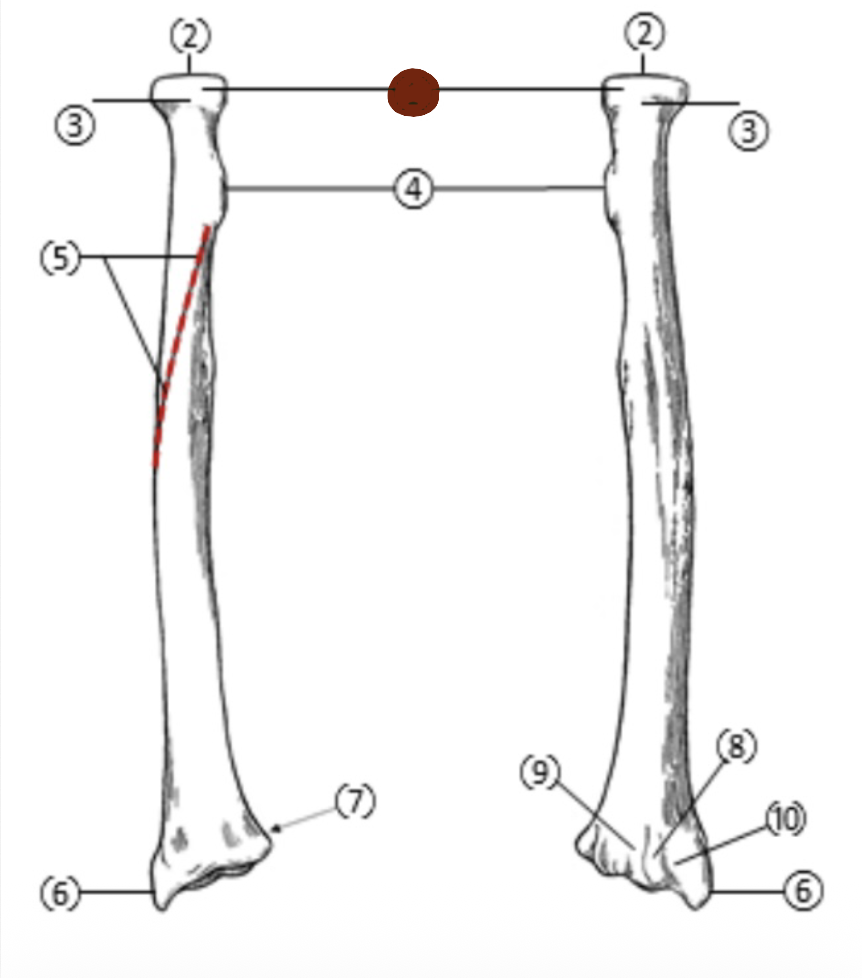 <p>On the Proximal end of the radius, which part is highlighted (1)?</p>