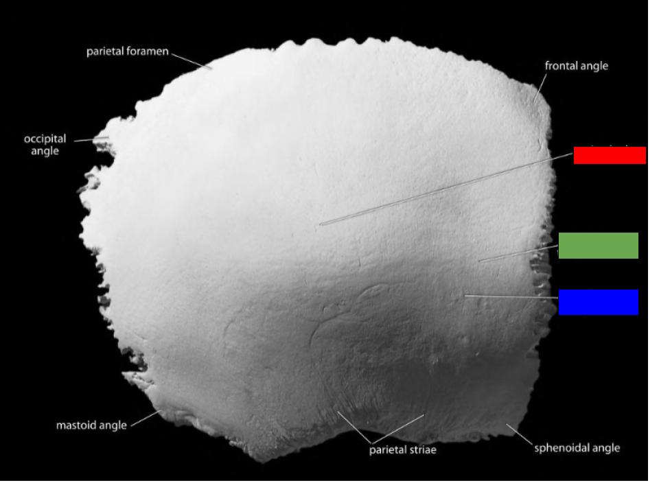 <p>What is the structure labeled in green?</p>