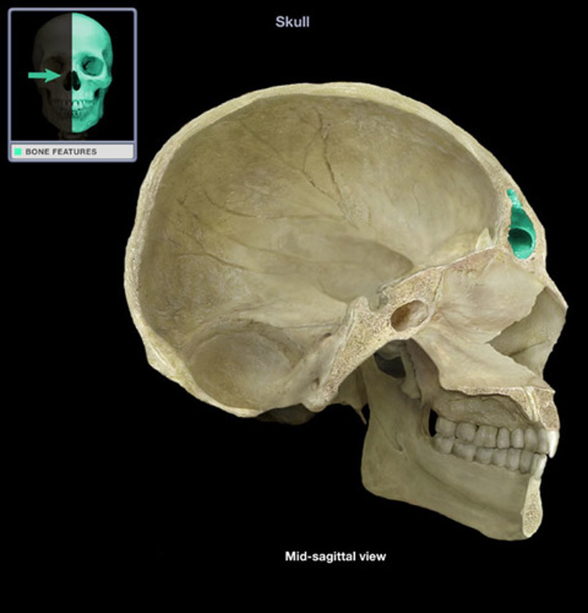 <p>cavity within the frontal bone<br>(purple in image)</p>