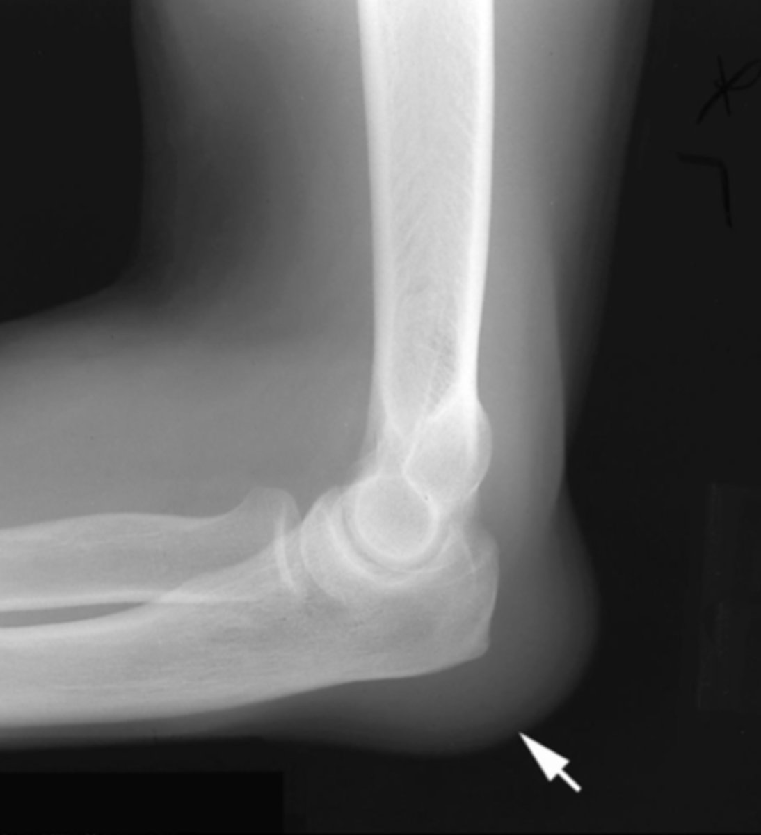 <p>What is the issue?</p>