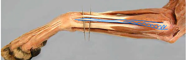 <p><span>Antebrachial Region (Forearm)</span></p>