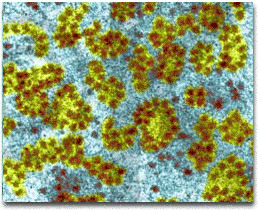 <p>non membrane bounded organelles responsible for protein synthesis;found in eukaryotes and porkaryotes</p>