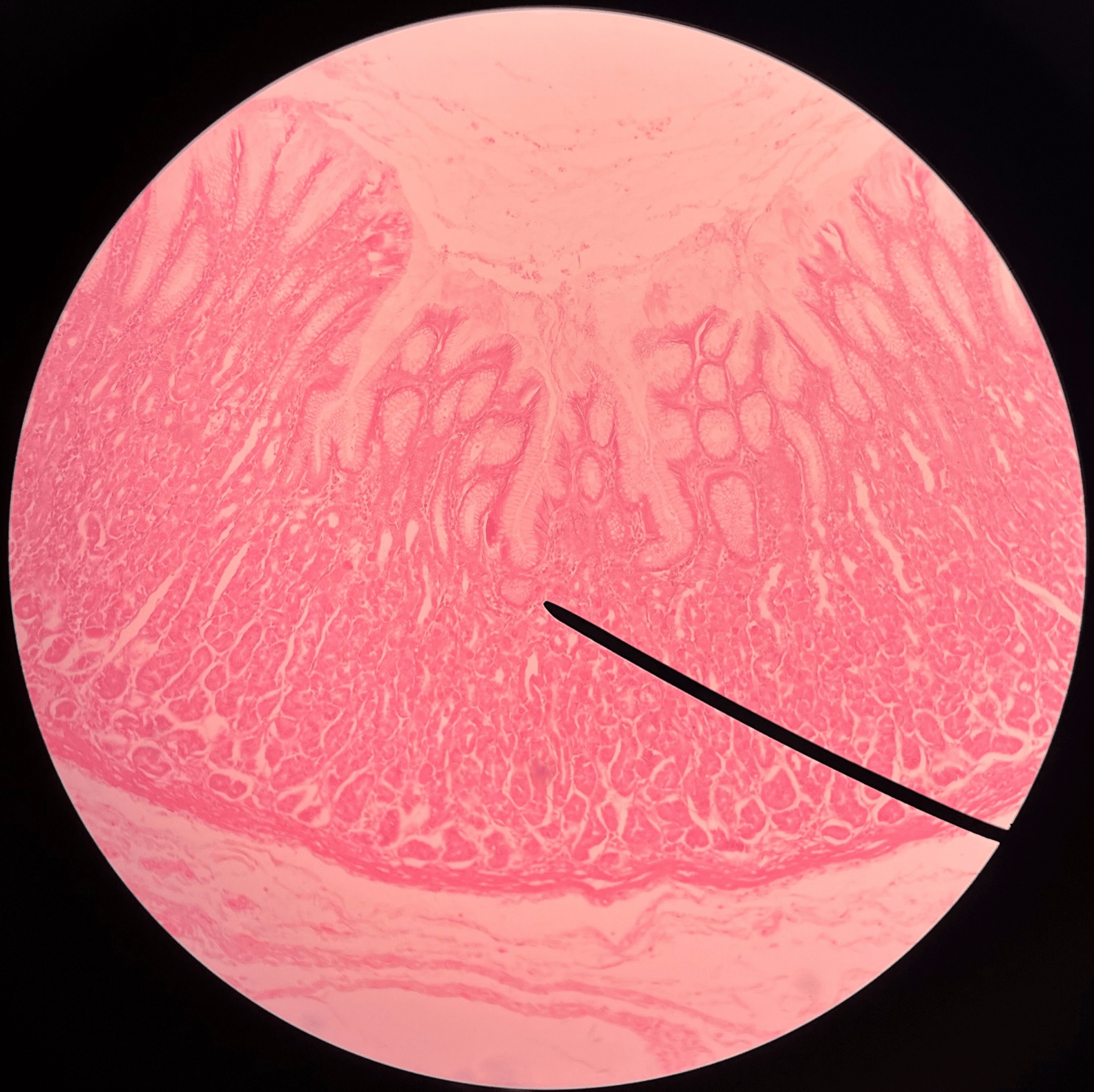 • Slide histology of the stomach.

• Located within gastric pits.

• Secretes gastric juice.