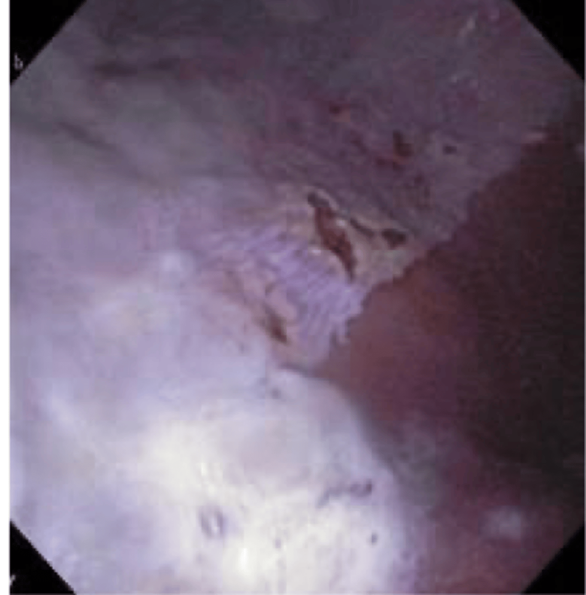 <p>gastric ulcers are most common in what kinds of horses</p>