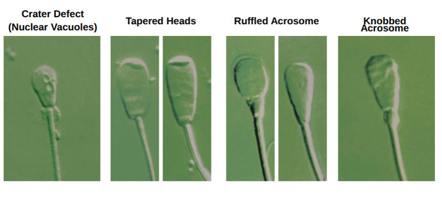 <p>would have implication for ability to get in and fertilise egg</p>