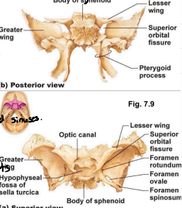 <p>Found between greater and lesser wings. Allows for passage of cranial nerves that control eye movement.</p><p>Sphenoid bone.</p>